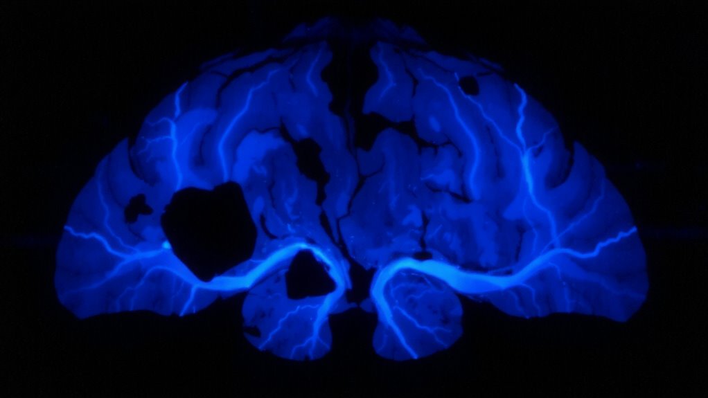 deep sleep enables brain detox